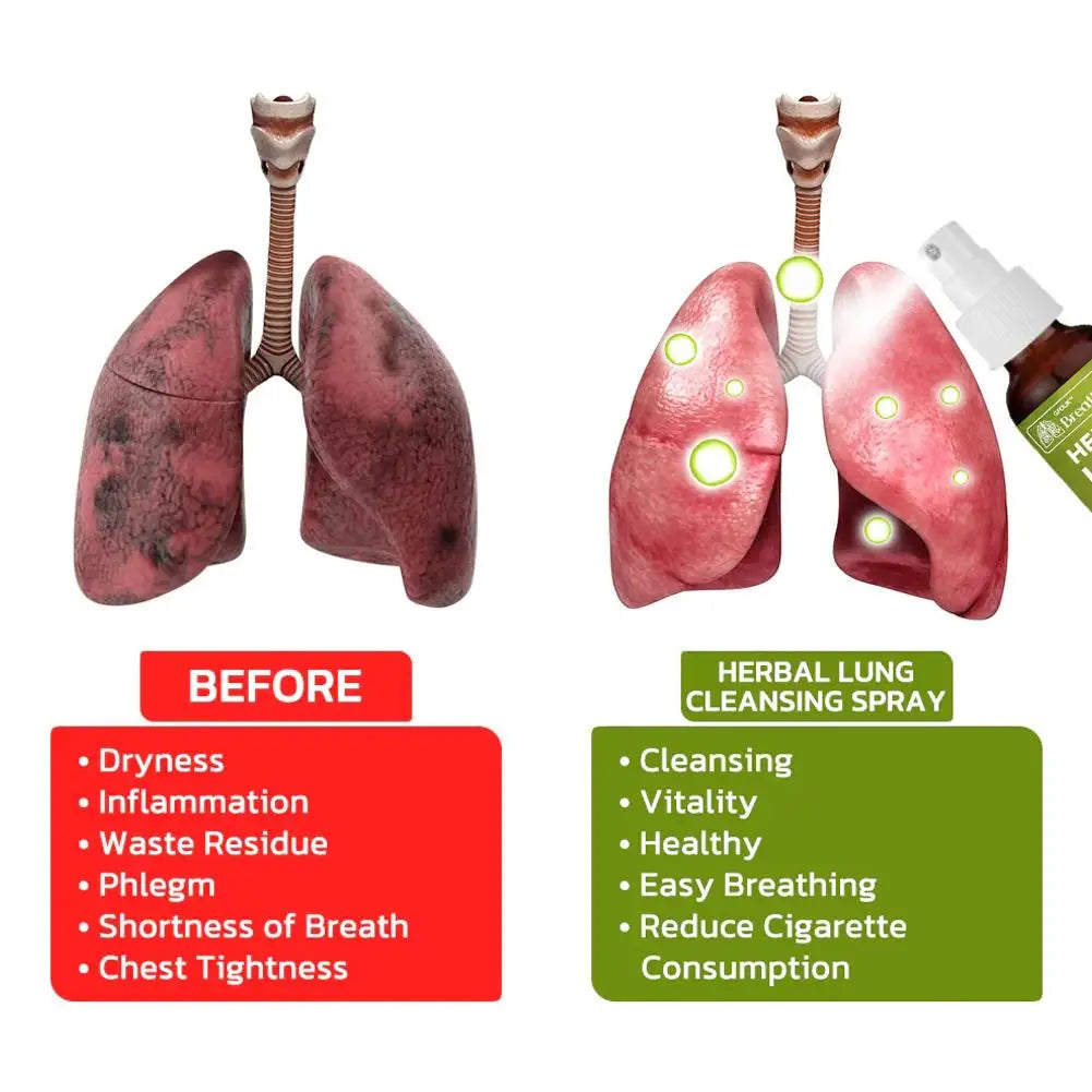 Throat Spray Lung Cleaning Herbal Body Health Ointment Care Inflammation Cleansing Cream Creams Skin Mouth Throat C0C3