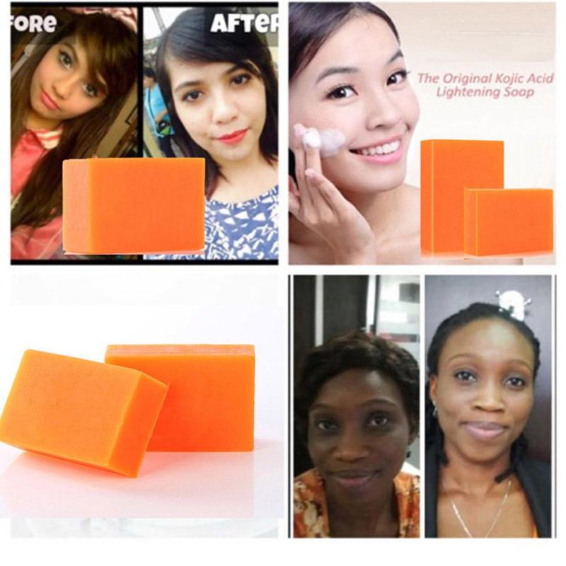 Kojic Acid Whitening Soap Turmeric Soap For Face And Body  Acne Dark Spot Remover Natural Herbal  Lightening Glow Scar Remover